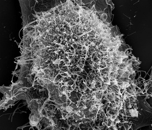 Ebola Virus Particles 