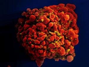 https://commons.wikimedia.org/wiki/Category:HIV#/media/File:HIV-infected_H9_T_Cell_(6813314147).jpg