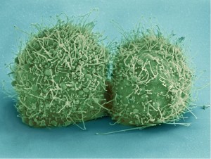 hela-cells-544318_960_720