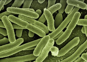 koli-bacteria-123081_960_720